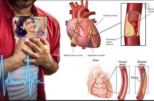 পুরুষের হার্ট অ্যাটাকের ঝুঁকি বাড়ায় সুন্দরীরা!