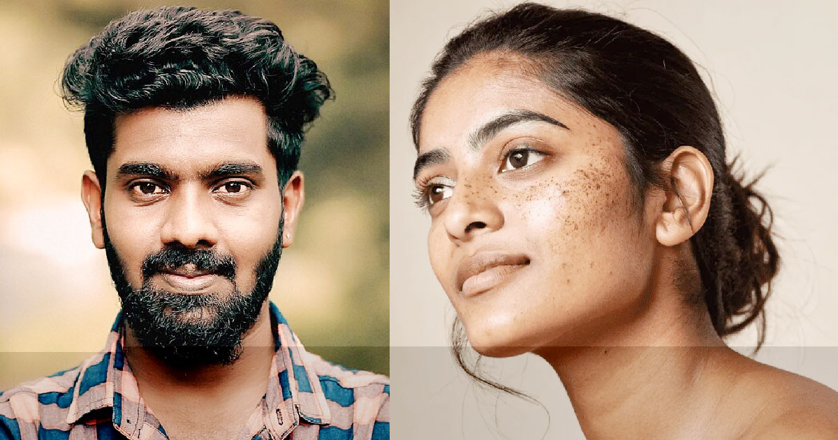 ছিলেন ফর্সা, যে ভিটামিনের অভাবে হয়ে যাচ্ছেন কালো