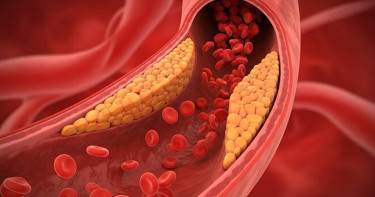 ধমনীতে ব্লক হলে আগেই যে সংকেত দেয় শরীর