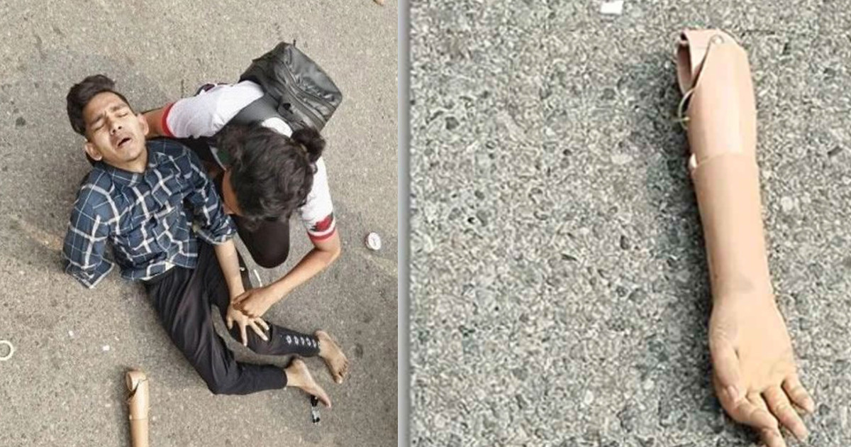 লাঠিচার্জে খুলে গেল জুলাইযোদ্ধার কৃত্রিম হাত, পড়ে রইল রাস্তায়