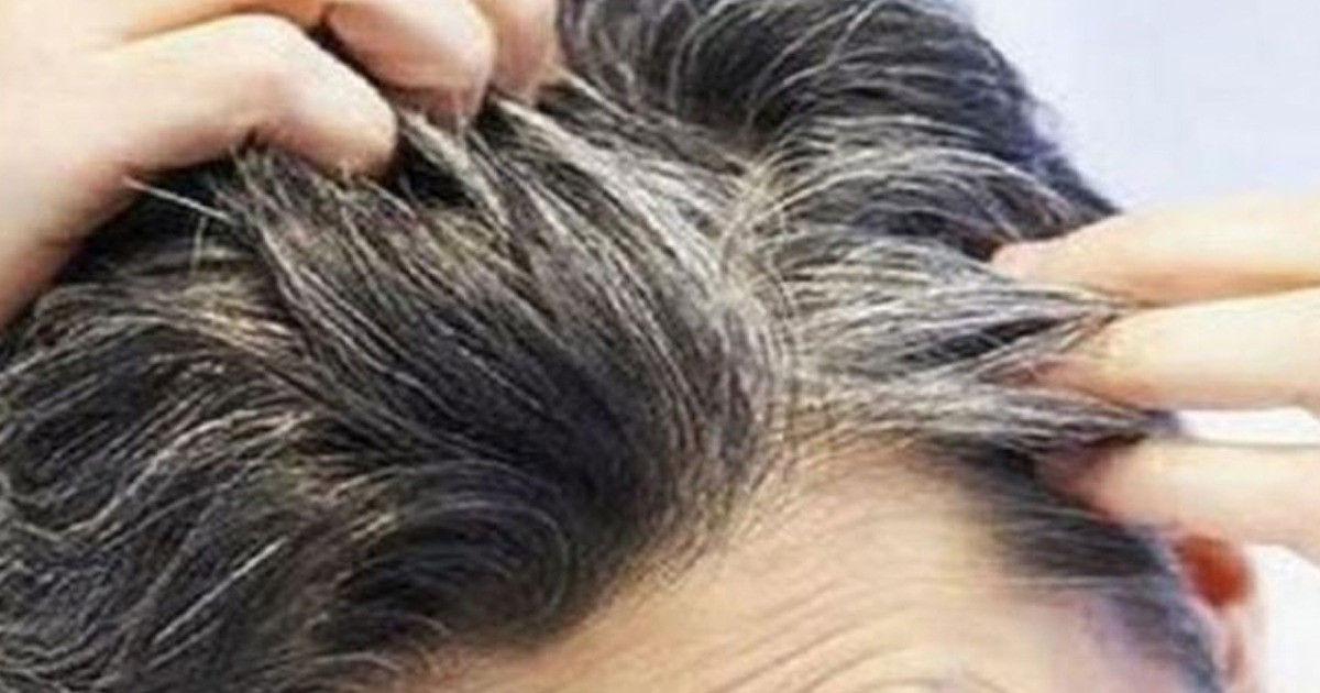 যে ভিটামিনের অভাবে অকালে চুল পাকে