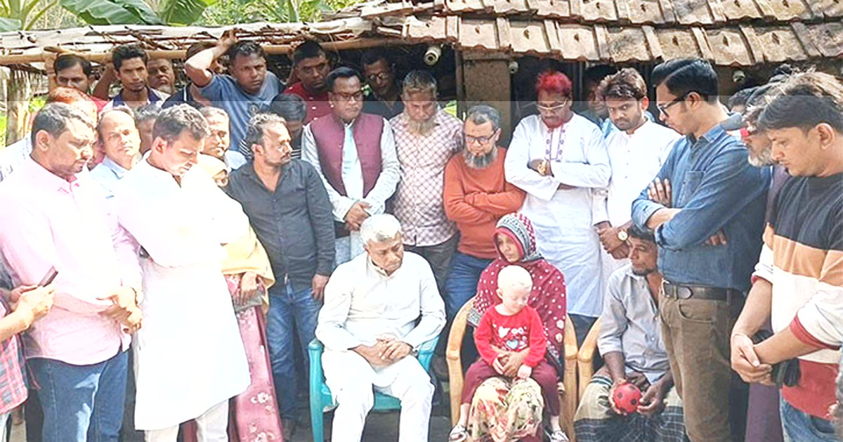 অসহায় শিশুটির পাশে দাঁড়ালের তারেক রহমান