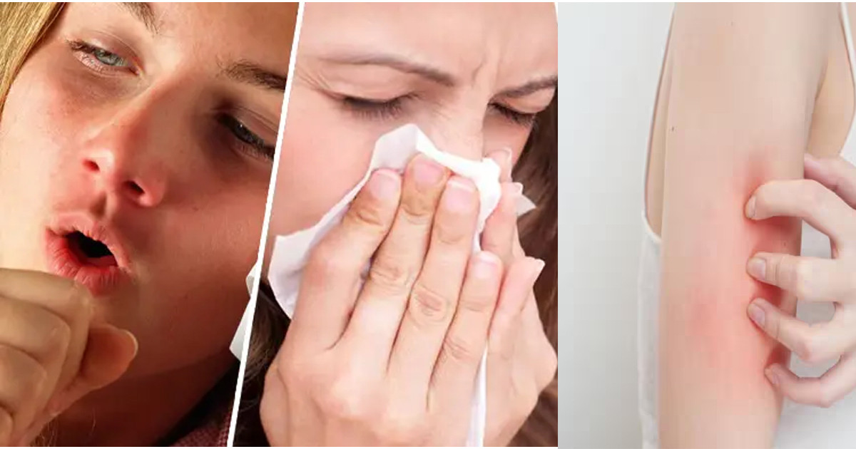 যে ভিটামিনগুলোর অভাবে অ্যালার্জি বাড়তে পারে