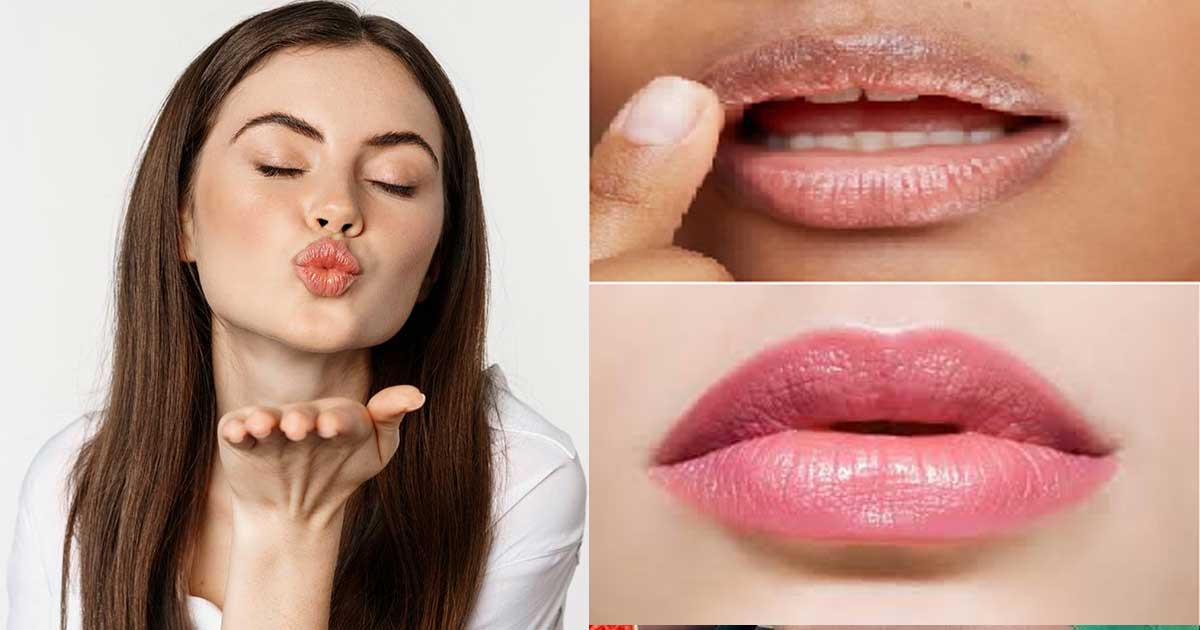 যে ভিটামিনের অভাবে ঠোঁটে কালচে দাগ পড়ে