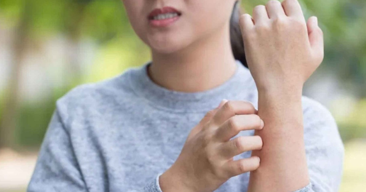 যে ভিটামিনের অভাবে শীতে চুলকানি বেড়ে যায়