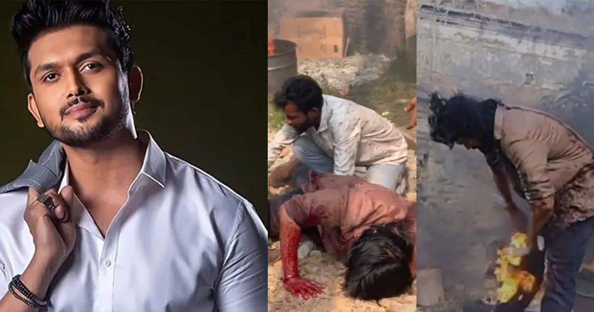 শুটিং সেটে অগ্নিদগ্ধ আরিফিন শুভ