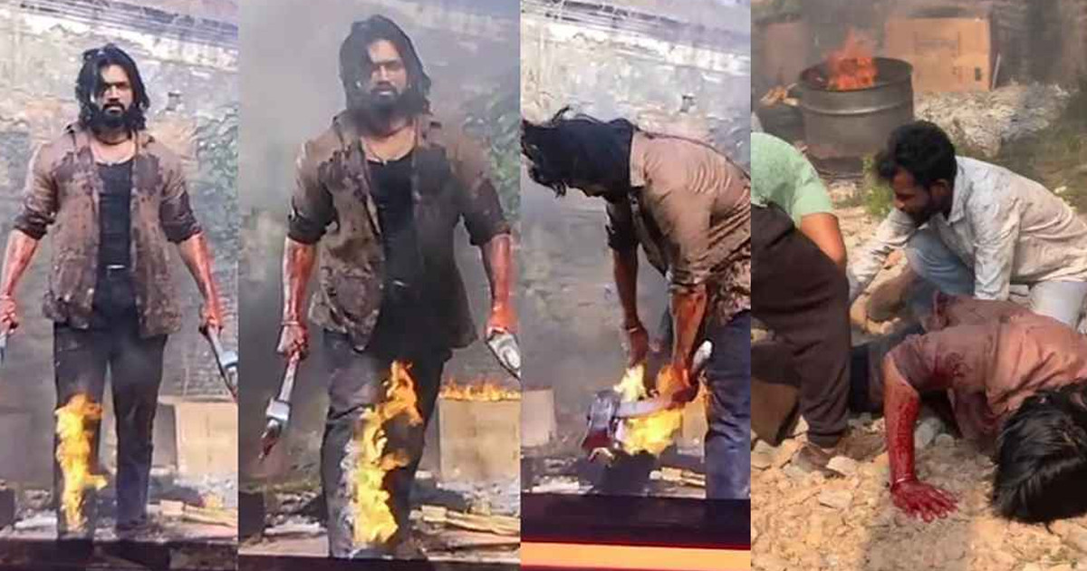 শুটিংয়ে অগ্নিদগ্ধ আরিফিন শুভ, সবশেষ যা জানা গেল