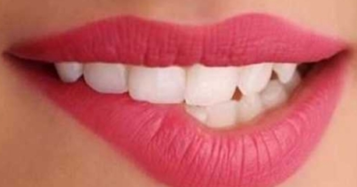 শুধু নারী-তারকারা নন, সাধারণ নারীরাও ঠোঁট সুন্দর করতে টাকা জমাচ্ছেন