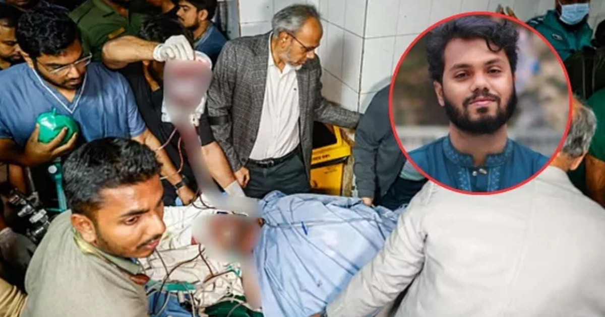 অস্ত্রোপচার সম্পন্ন, হাদির মাথায় গুলি পাওয়া যায়নি