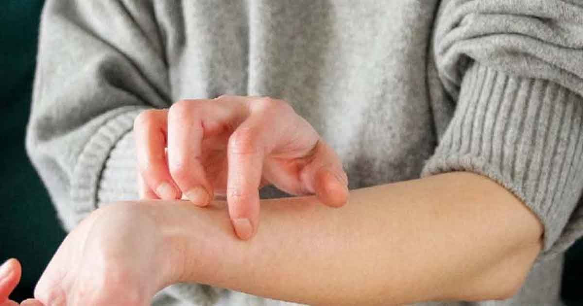 শীত আসলেই চুলকানি? জেনে নিন কোন ভিটামিনের অভাব