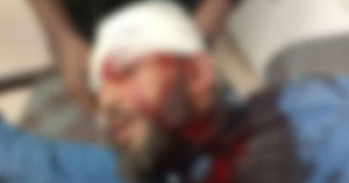 এবার এনসিপি নেতাকে গুলি