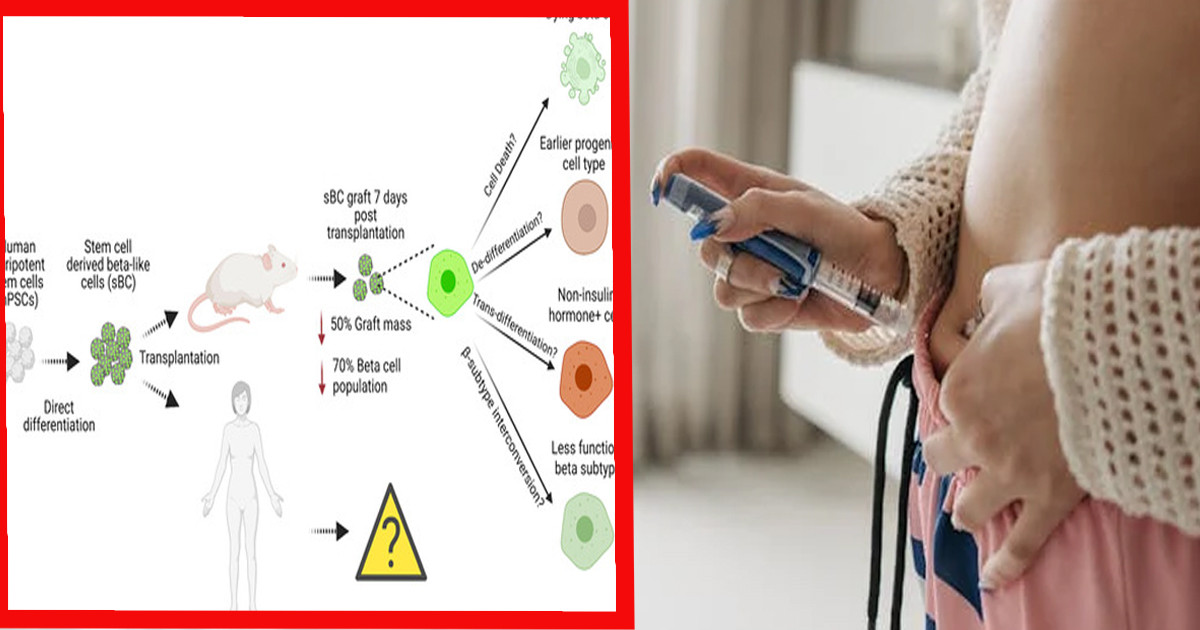 চীনা বিজ্ঞানীদের সাফল্য, ডায়াবেটিস নিয়ন্ত্রণে লাগবে না ইনজেকশন