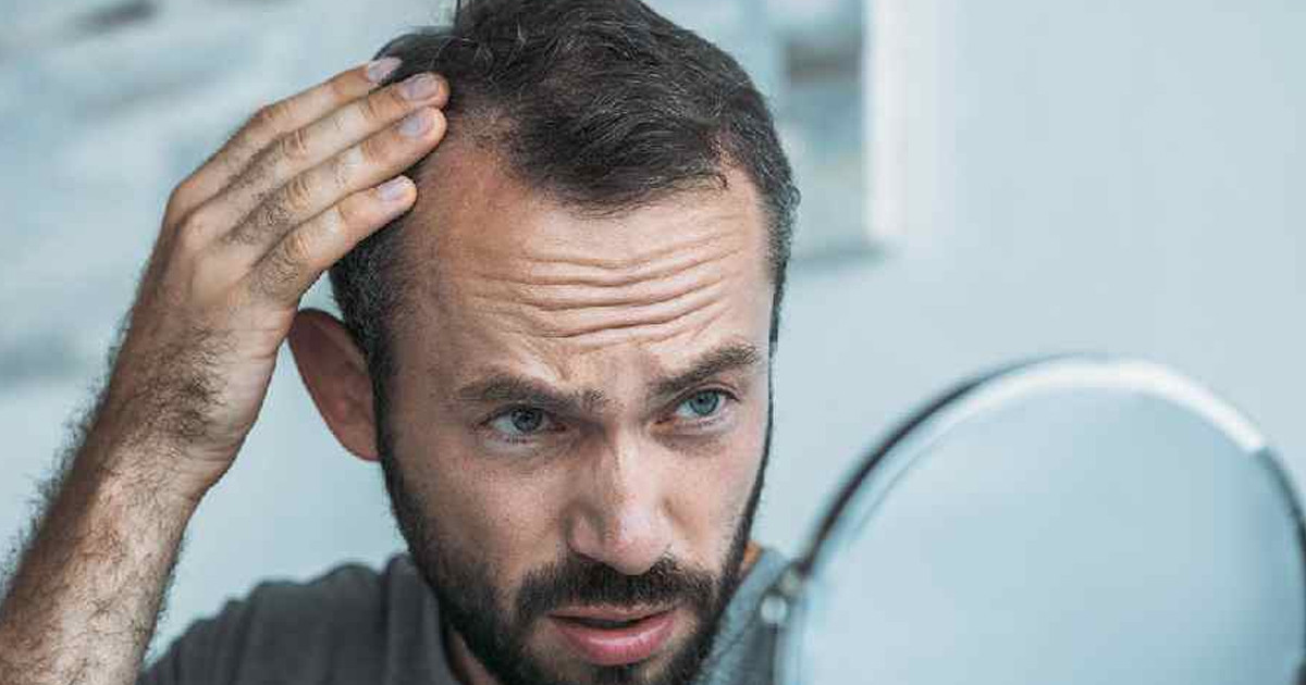 যেসব কারণে পুরুষদের অতিরিক্ত চুল পড়ে