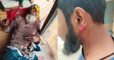 সিরাজগঞ্জে দুই পক্ষের সংঘর্ষ, আহত ১০