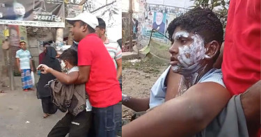 বিএনপির সমাবেশের প্রস্তুতিকালে বিস্ফোরণ, দগ্ধ ২১
