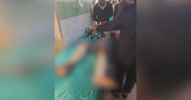 কৃষকদল নেতার ওপর হামলা, হাত-পায়ের রগ কর্তন