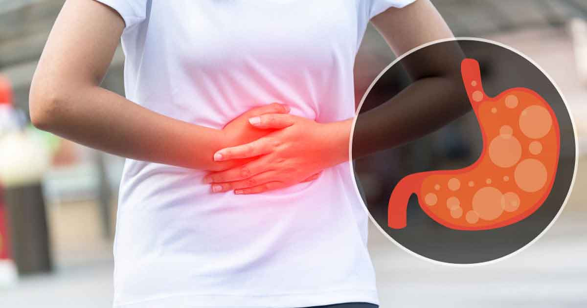 ইফতারের পর অ্যাসিডিটি হয়? যা করবেন