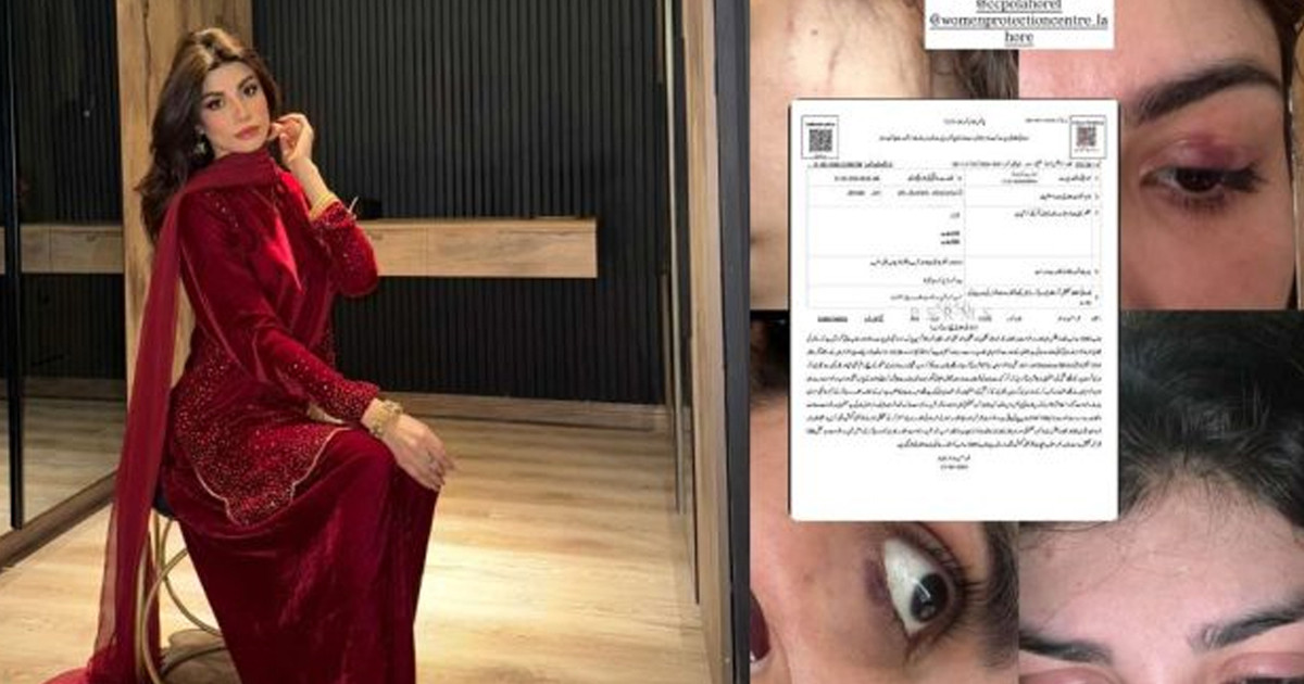 স্বামীর বিরুদ্ধে নির্যাতনের অভিযোগ মডেলের