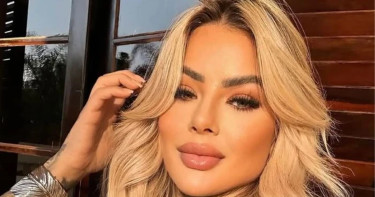 কসমেটিক সার্জারির পর ২০ বছর বয়সি ইনফ্লুয়েন্সারের মৃত্যু