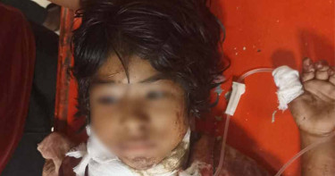 সীতাকুণ্ডের ইকোপার্কে গলা কাটা সেই শিশুটি মারা গেছে