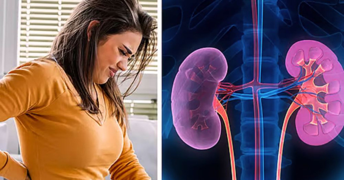 কিডনিতে পাথর প্রতিরোধের সহজ উপায়