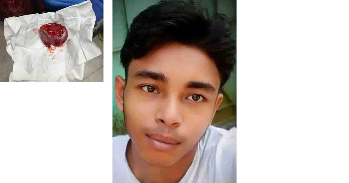 শরীর থেকে কলিজা কেটে আলাদা, বের করা হয় ভুঁড়ি, সেই কিশোরের মৃত্যু