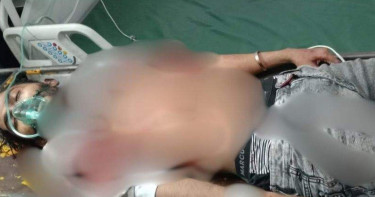 গুলিবিদ্ধ কনটেন্ট ক্রিয়েটর রাকিব মারা গেছেন