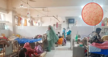 হামে আক্রান্ত হয়ে ১৫ জনের মৃত্যু