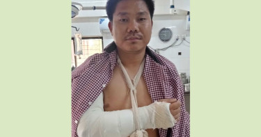 অকটেন না দেওয়ায় ট্যাগ অফিসারের হাত ভেঙে দেওয়ার অভিযোগ