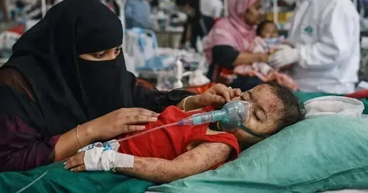 গত ২৪ ঘণ্টায় হাম ও হামের উপসর্গ নিয়ে কত শিশুর মৃত্যু?