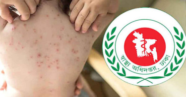 হামে আক্রান্ত হলে করনীয় কী?