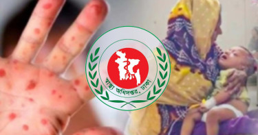 দেশে হামের ভয়াবহ প্রকোপ, থামছেই না শিশুমৃত্যু