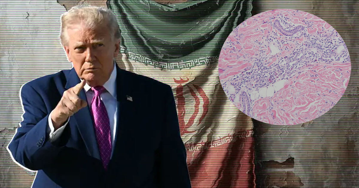 কী এই ‘নিউক্লিয়ার ডাস্ট’? যা নিয়ে ইরান ও ট্রাম্পের মধ্যে চলছে টানাটানি