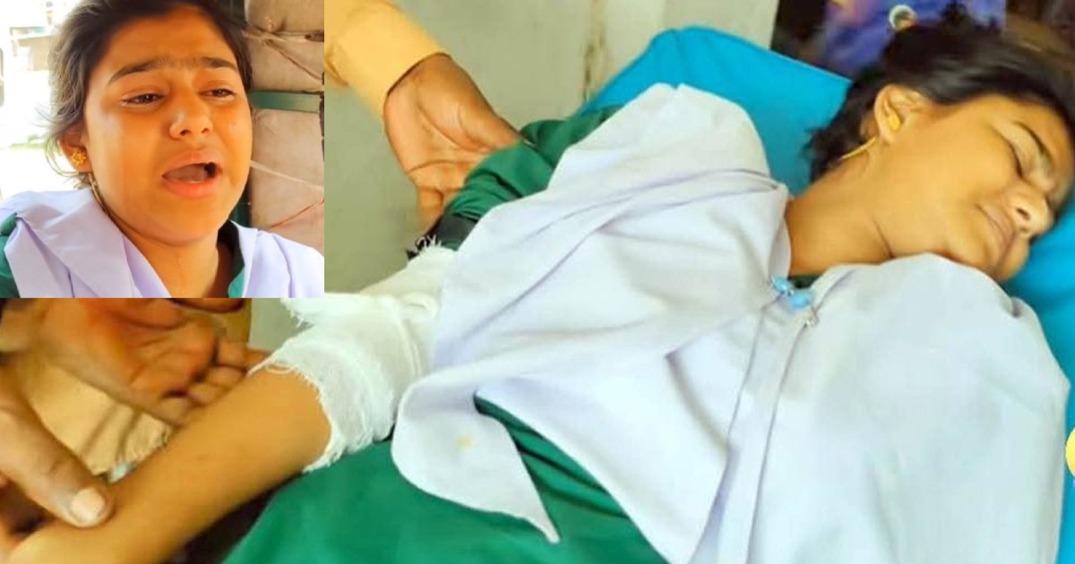 হাতুড়ি দিয়ে পিটিয়ে এসএসসি পরীক্ষার্থীর হাত ভেঙে দিলেন চাচা