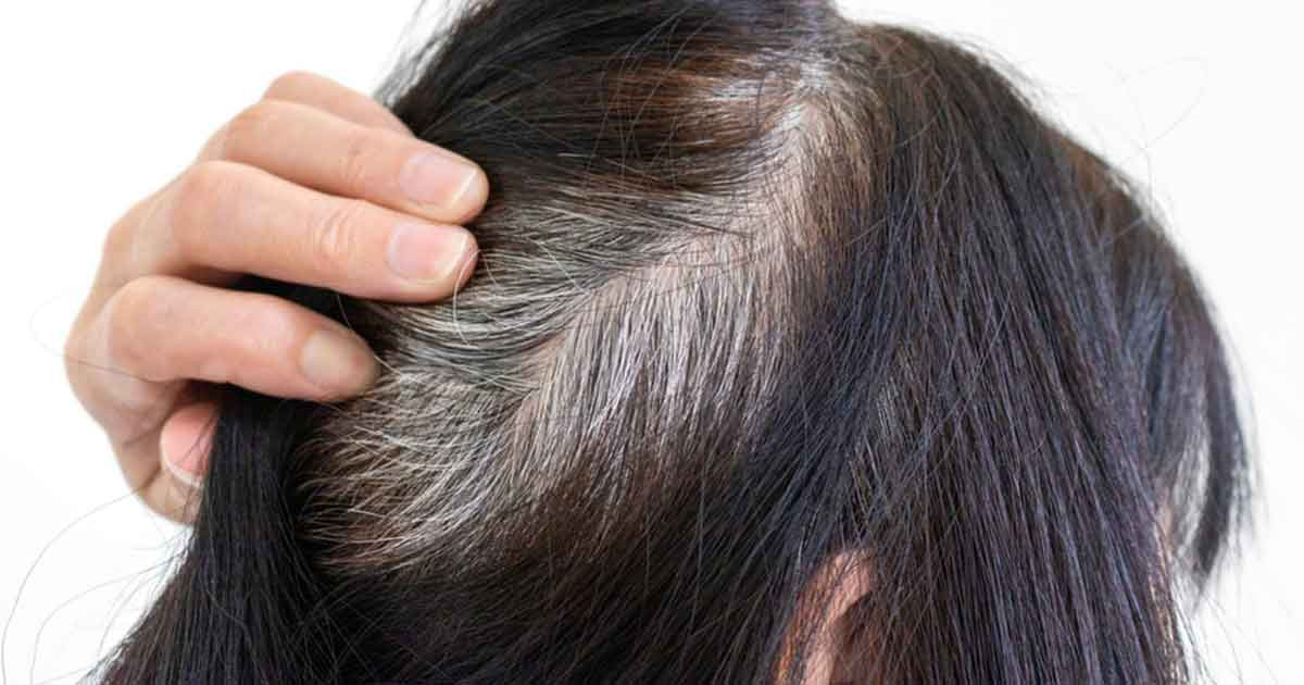 অল্প বয়সে চুল পাকা নিয়ে যা বলছেন বিশেষজ্ঞরা