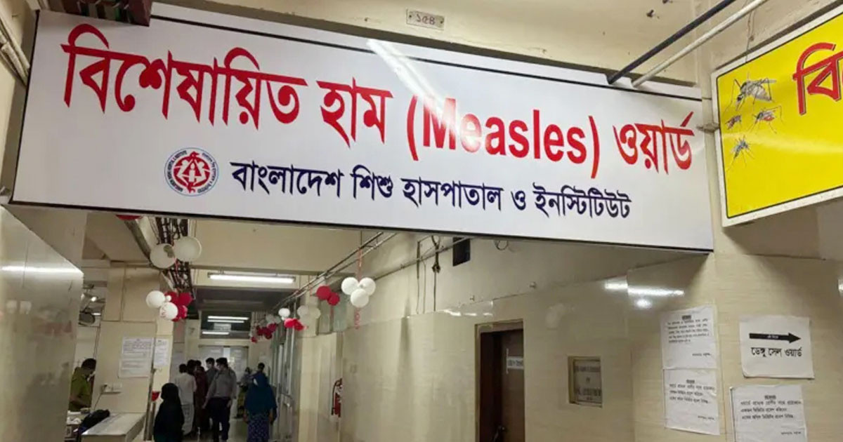 হাম ও হামের উপসর্গে আরও ৭ জনের মৃত্যু