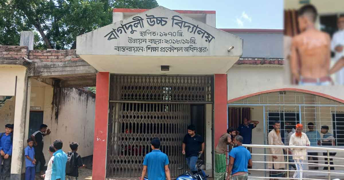 শিক্ষকের বেত্রাঘাতে হসপিটালে ছাত্র, শিক্ষক অবরুদ্ধ