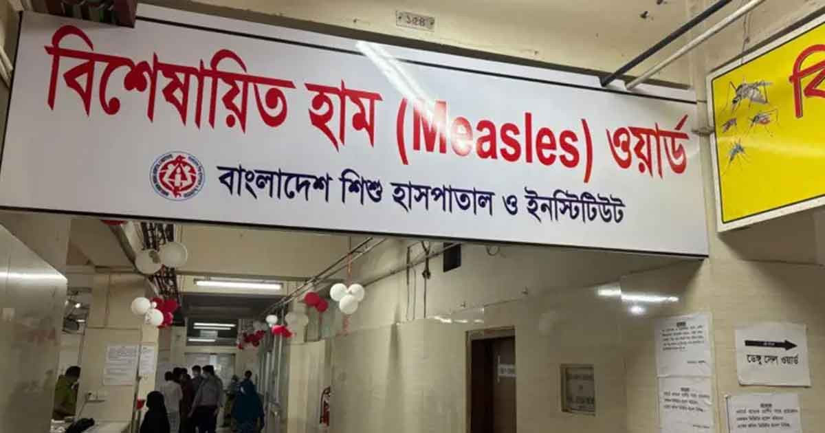 হাম ও উপসর্গে ২৪ ঘণ্টায় ১১ শিশুর মৃত্যু, আক্রান্ত ১৩১৫