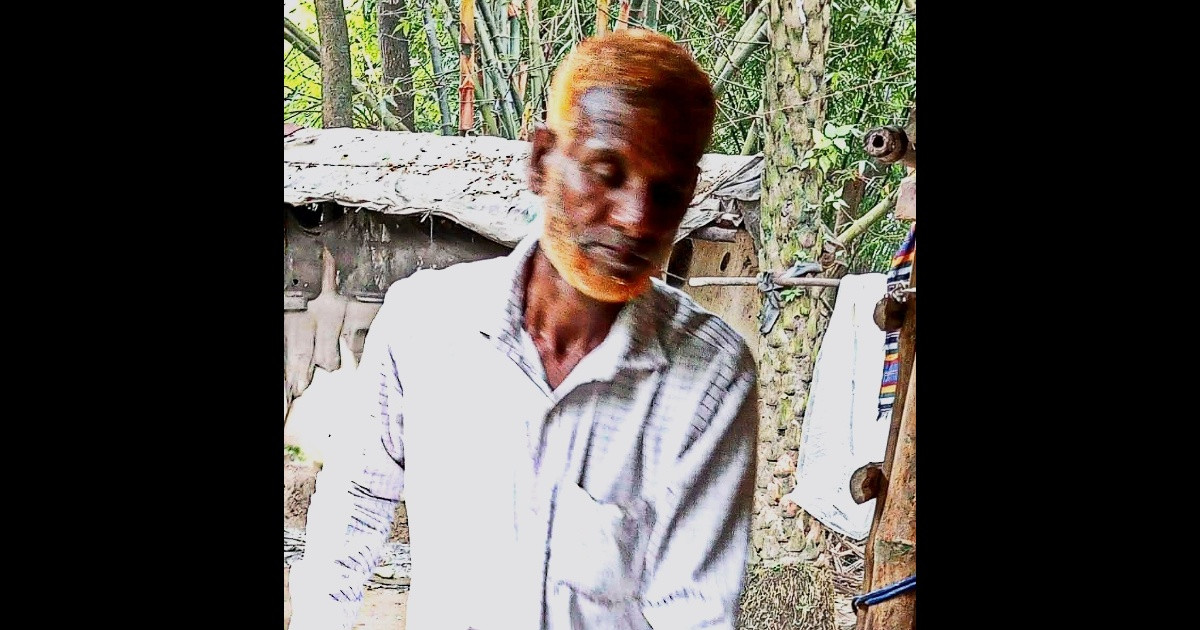 গলায় আম আটকিয়ে এক ব্যক্তির মৃত্যু