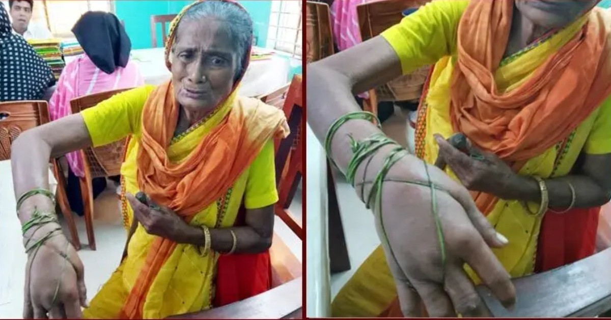 বিনা চিকিৎসায় কাতরাচ্ছেন কাঙালিনী সুফিয়া, চাইলেন সাহায্য