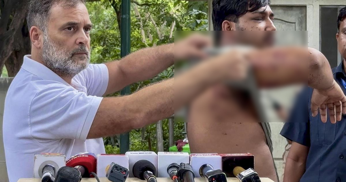 ‘গুলি চালিয়েও অস্বীকার’, মোদি সরকারের বিরুদ্ধে প্রমাণ তুলে ধরলেন রাহুল