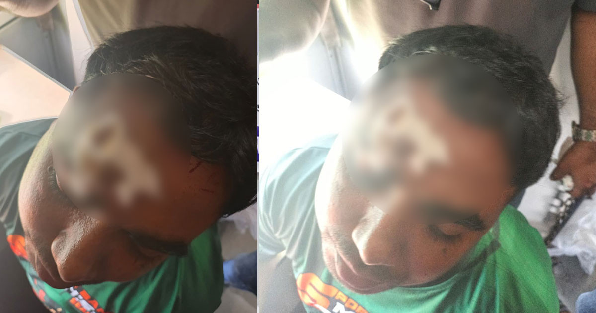 কক্সবাজার এক্সপ্রেস ট্রেনে পাথর নিক্ষেপ, গ্লাস ভেঙে যাত্রী আহত